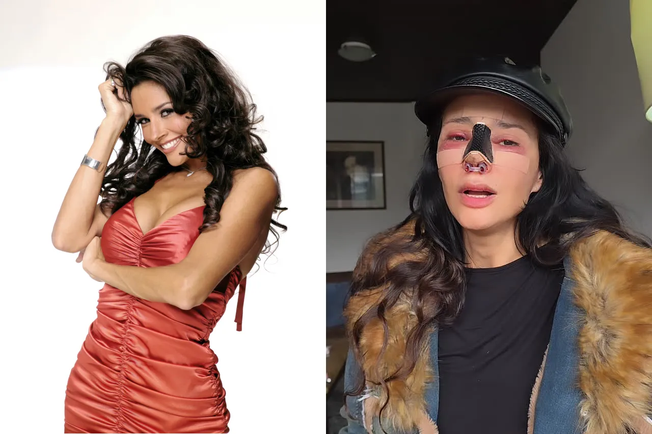 Tragedia en la Carrera del Espectáculo: La Famosa Actriz Dorismar Vuelta a Cero después de una Cirugía Estética que Se Convirtió en Catástrofe