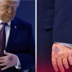 El misterio detrás del golpe: la Casa Blanca revela los detalles sobre la lesión que deja fuera de combate al Presidente de EE.UU.